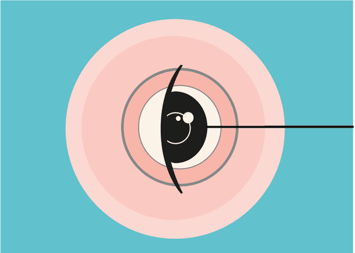 Illustration of an eye